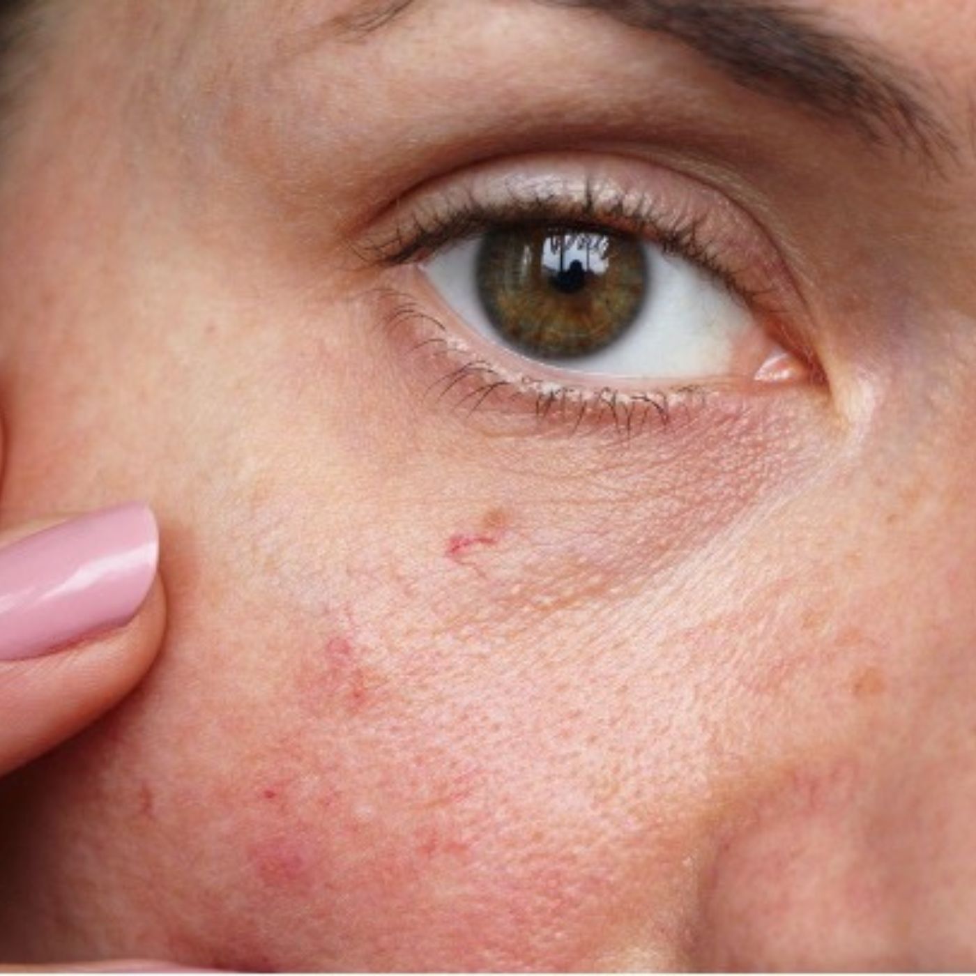 How to Soothe Sensitive Skin in 3 Easy Steps