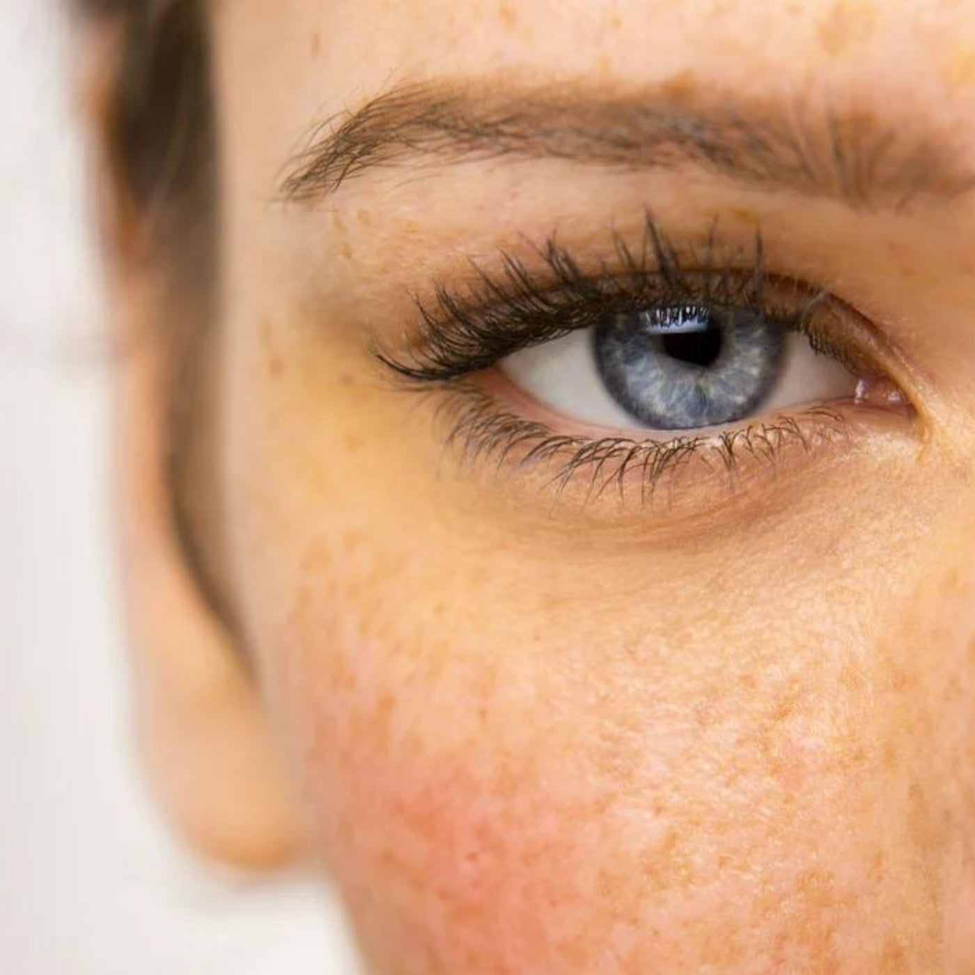 How to treat and reduce facial pigmentation and age spots