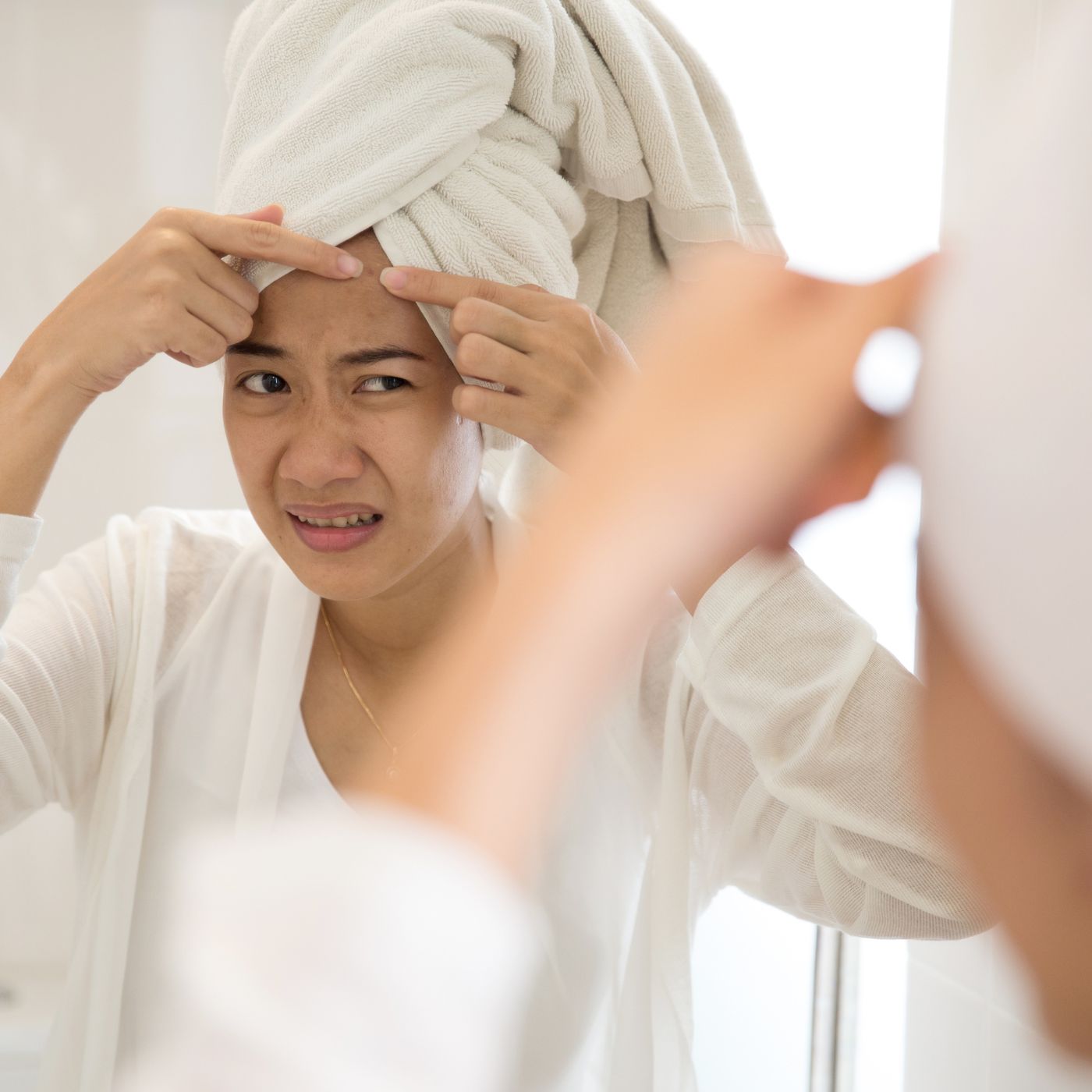 Steps to manage acne and breakouts: How to prevent it and how to treat breakouts.