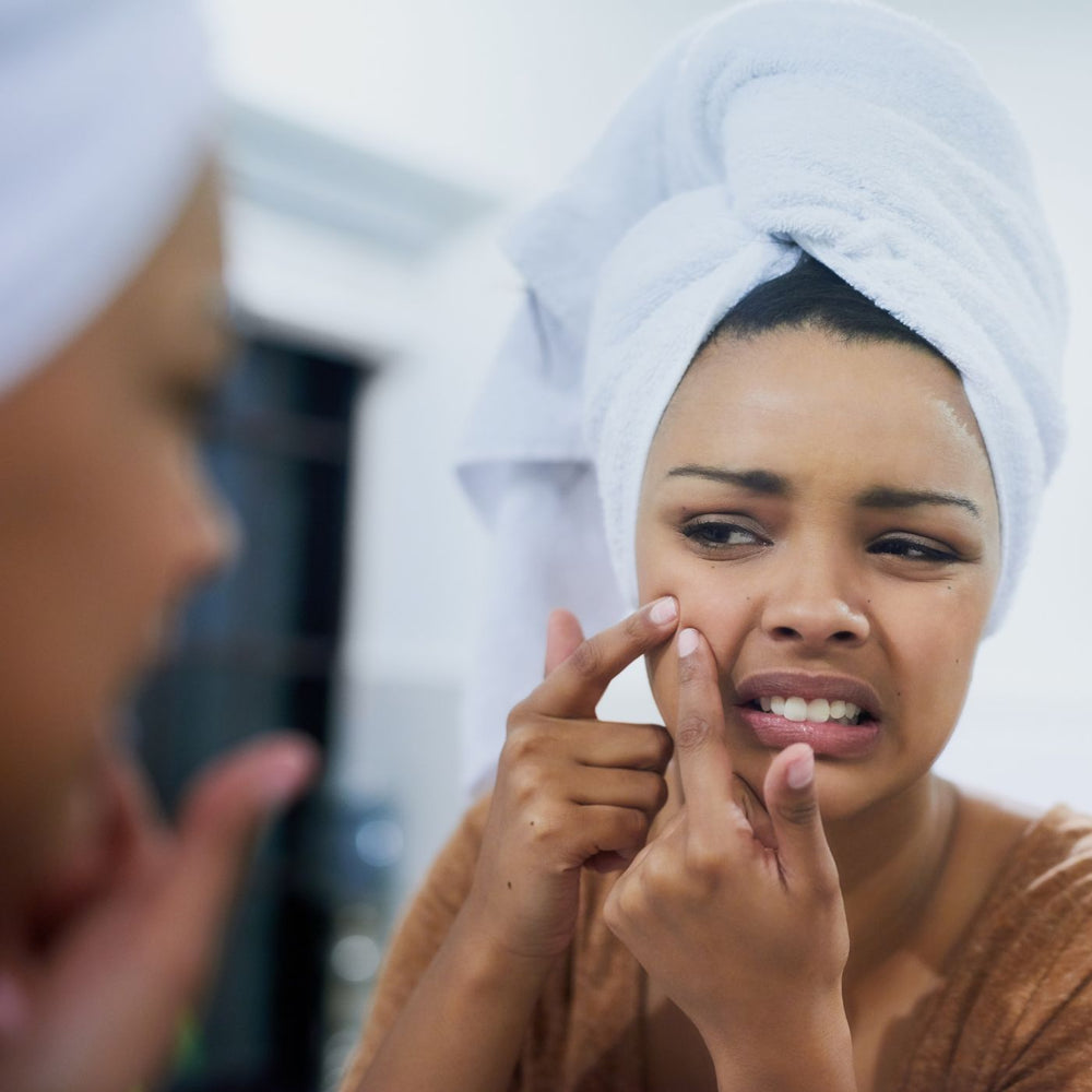 The difference between hormonal and stress-related acne and how to treat them