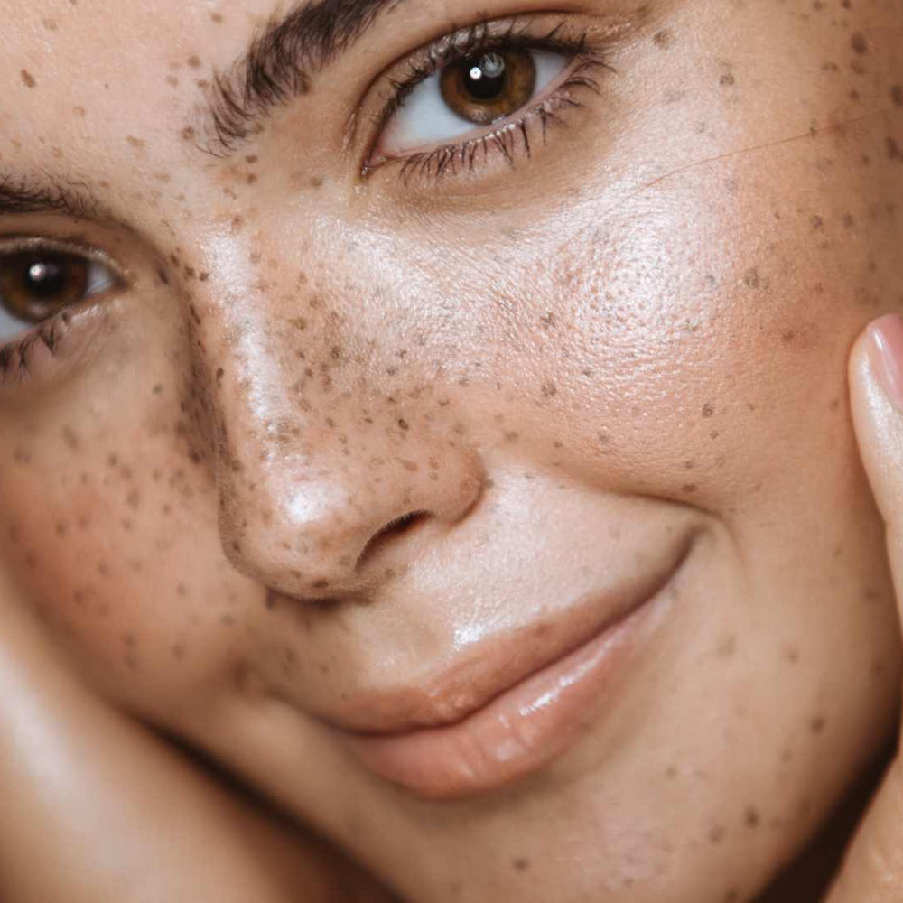 Everything you needed to know about your skin barrier.