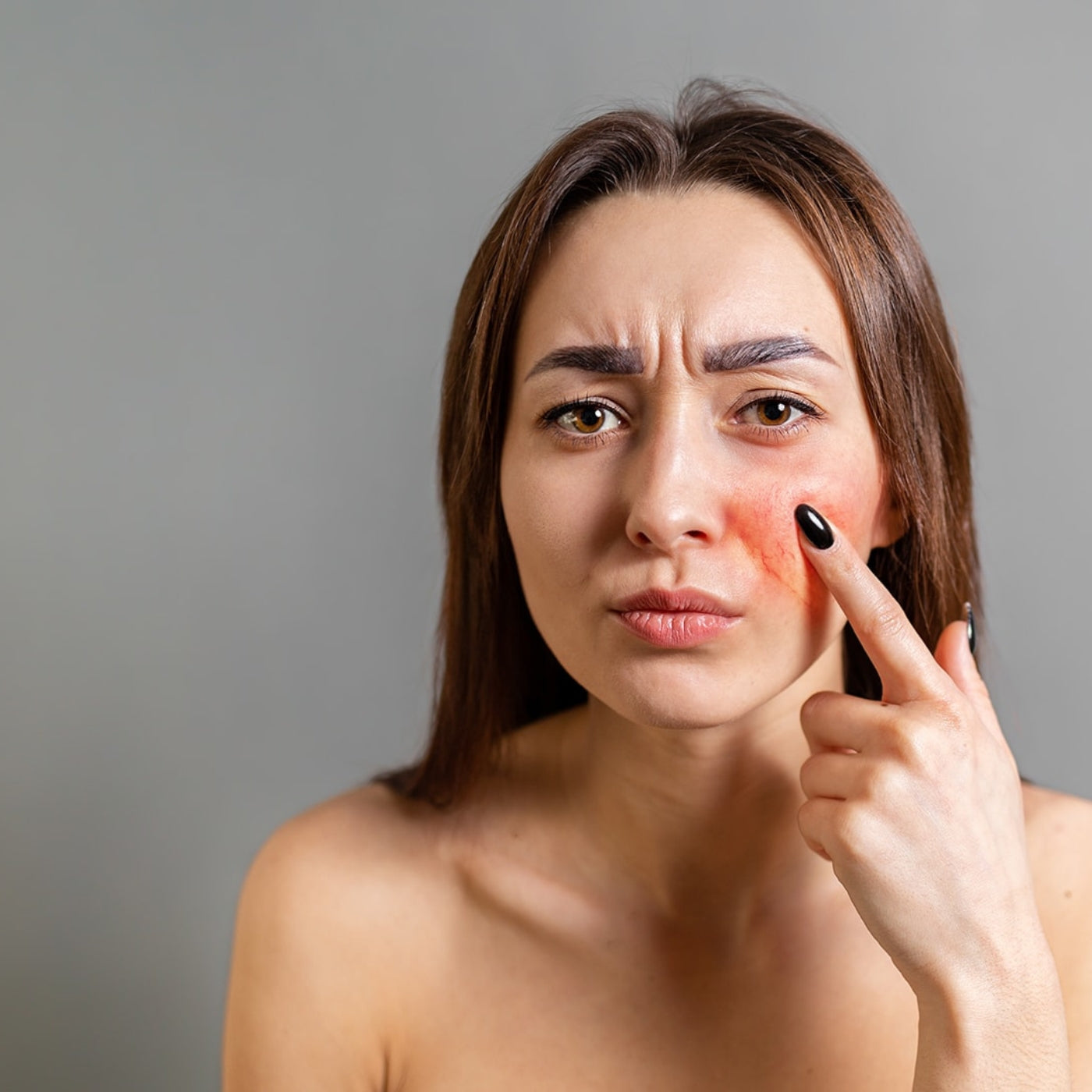How To Reduce Redness, Irritation, and Inflammation
